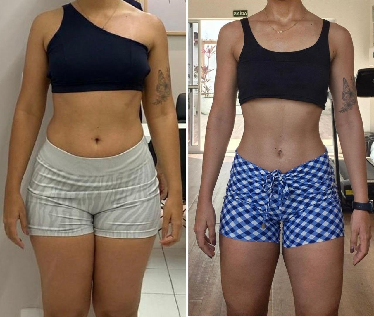 Paciente que perdeu 9,7 kg em quatro meses